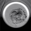 El Embryoscope, un incubador de embriones que aumenta las posibilidades de embarazo