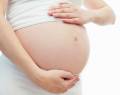 Cómo evitar las estrías de embarazo